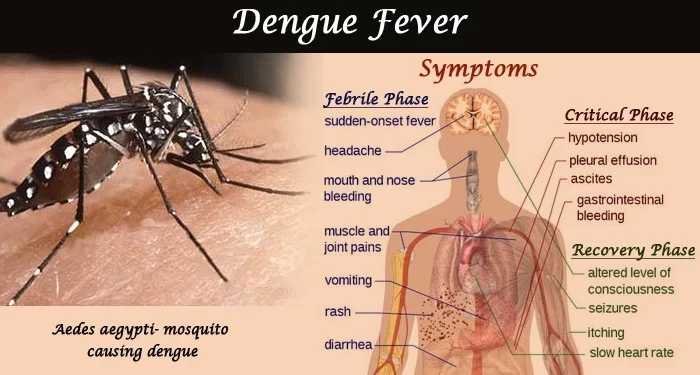 Dengue Fever