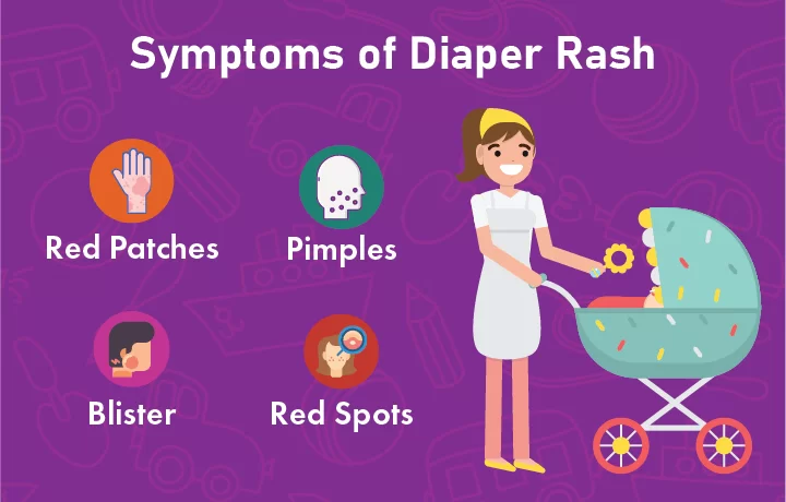 Diaper Rash