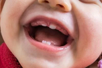 Teething