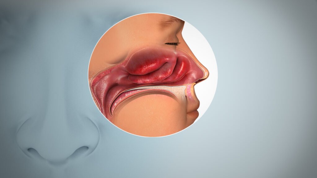 HOW TO TREAT SINUS PERMANENTLY WITH HOMOEOPATHY?