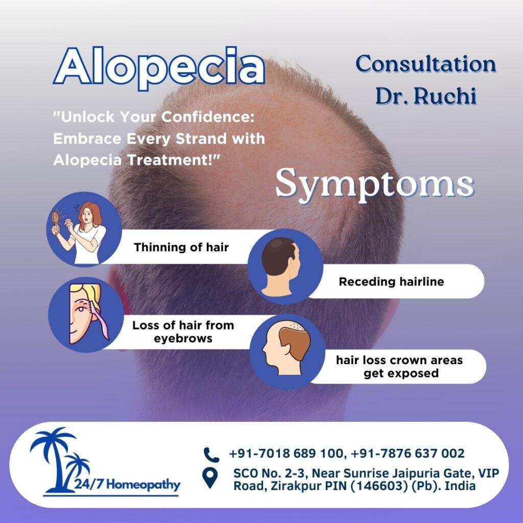Alopecia TREATMENT 247 HOMEOPATHY CLINIC