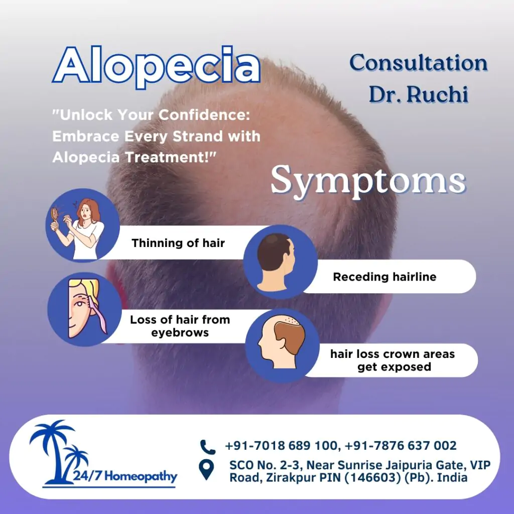 Alopecia TREATMENT 247 HOMEOPATHY CLINIC