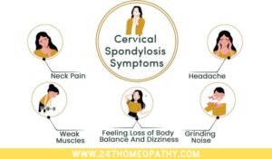 Cervical Spondylosis