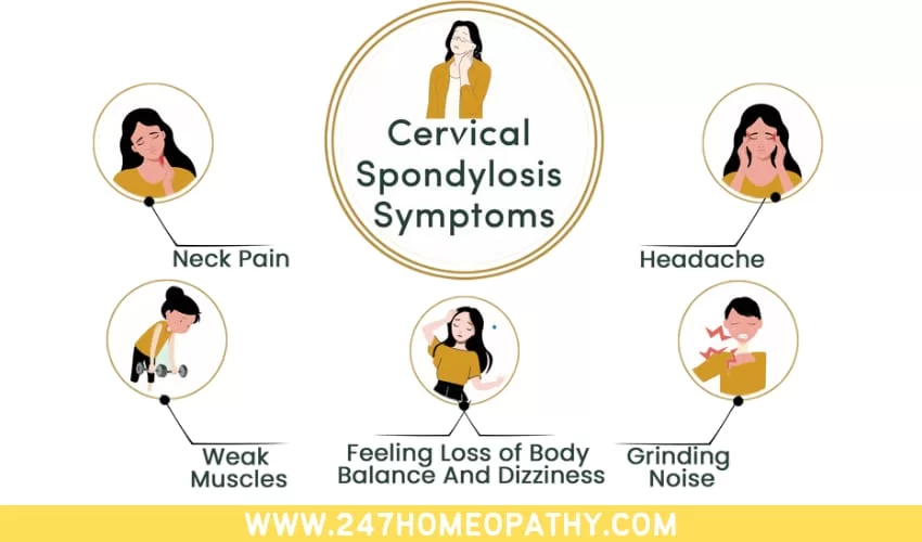 Cervical Spondylosis