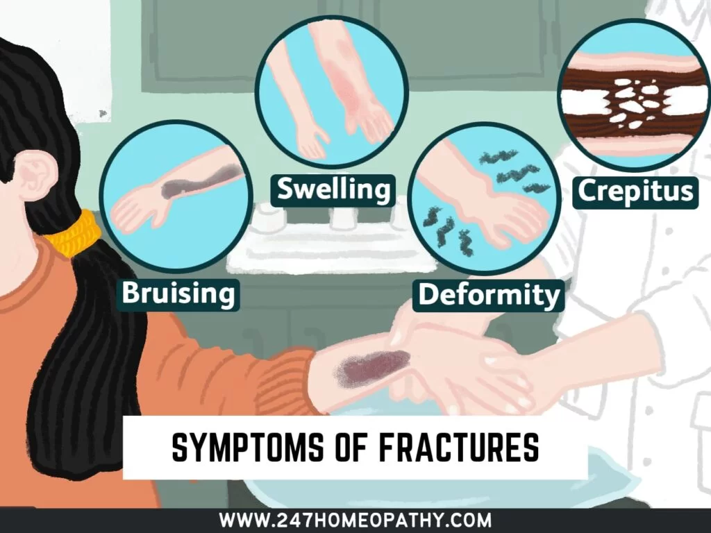 Fractures
