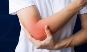 Tennis Elbow Homeopathy Treatment