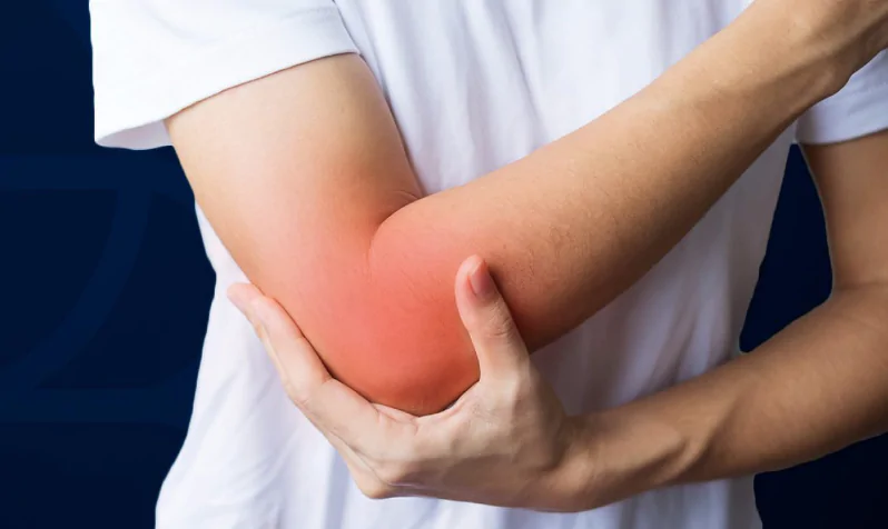 Tennis elbow