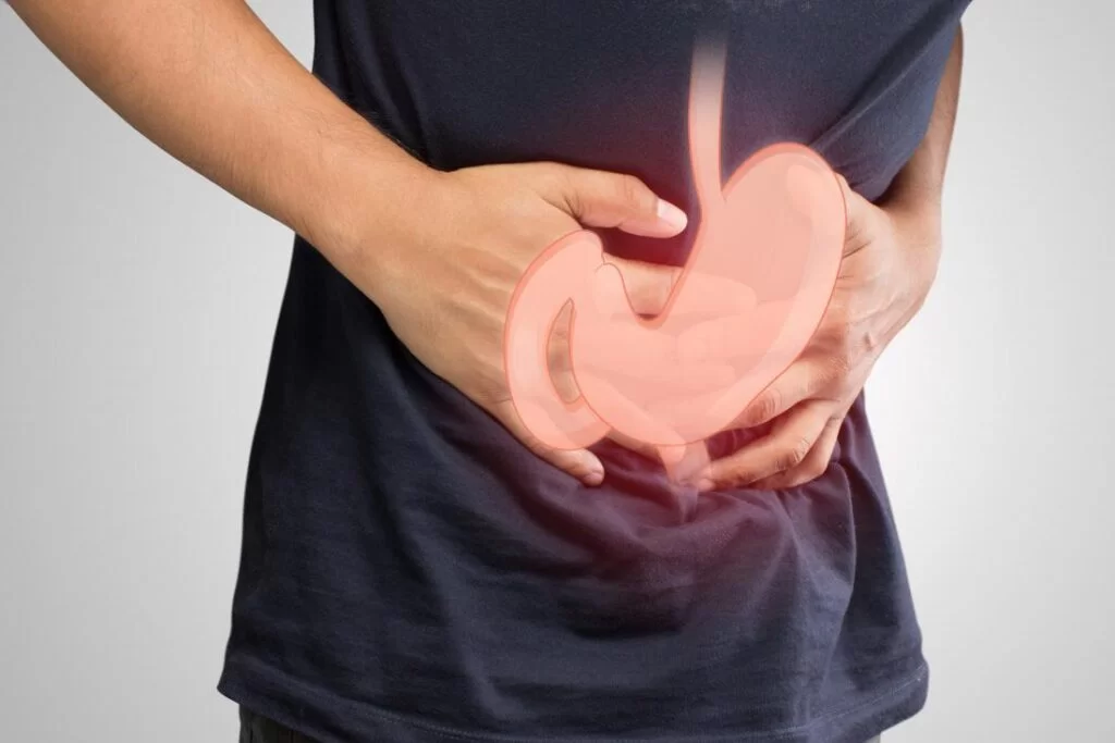 Gastroparesis