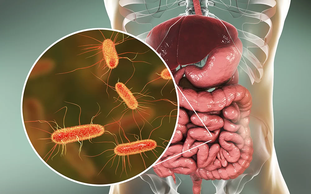 Escherichia Coli Infection