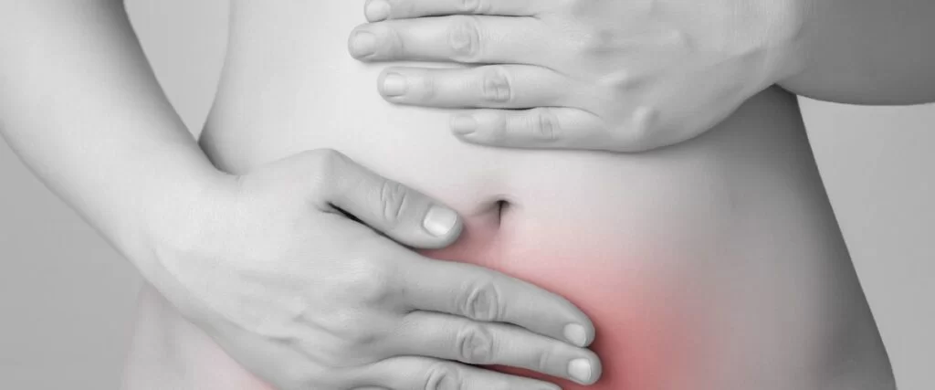 Endometriosis