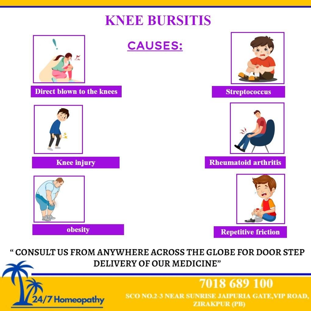 Pain in the Knee CAUSES