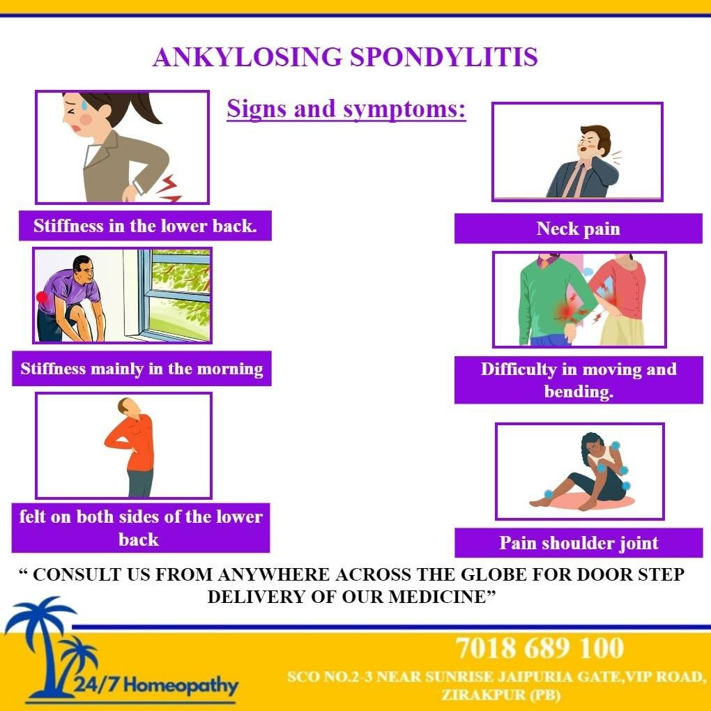 Signs and symptoms of ankylosing spondylitis