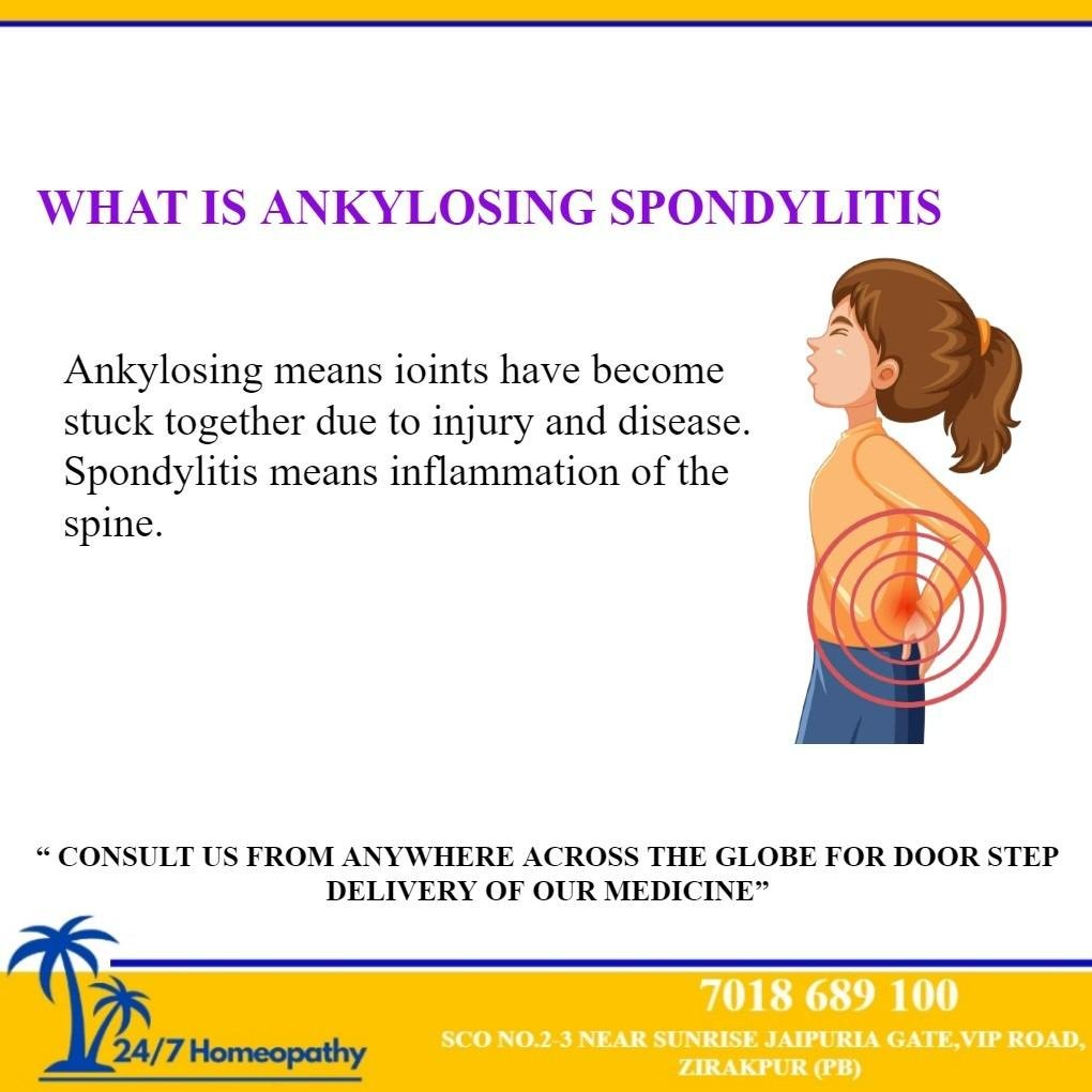 Ankylosing spondylitis