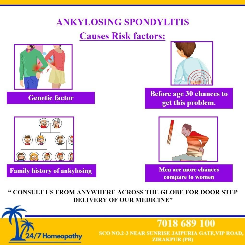 Risk factors of ankylosing spondylitis
