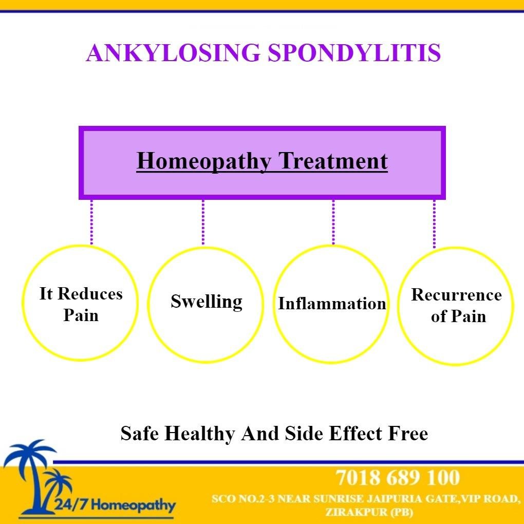 ankylosing spondylitis homeopathy treatment 