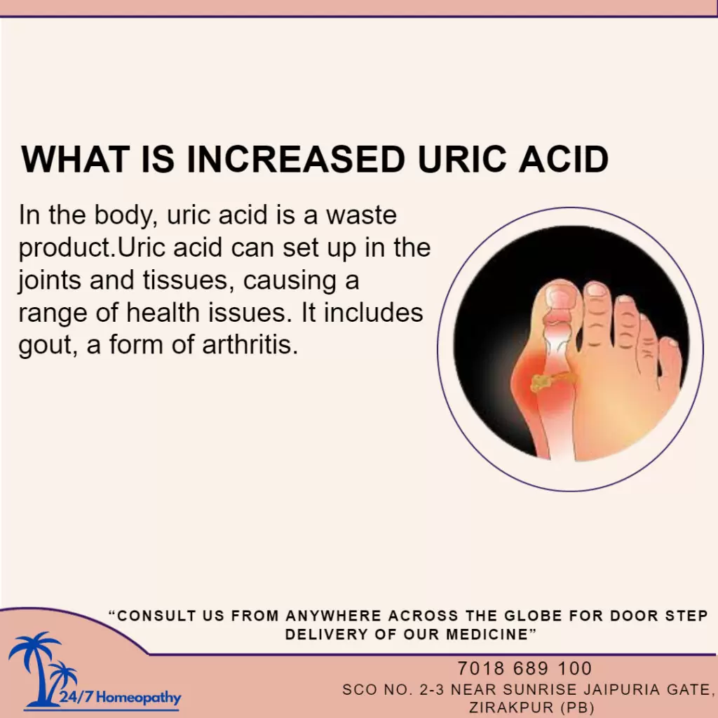 Uric Acid Homeopathic Medicine and Treatment
