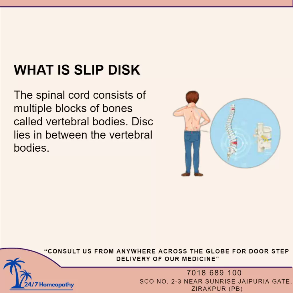 slip disc homeopathy treatment in zirakpur 