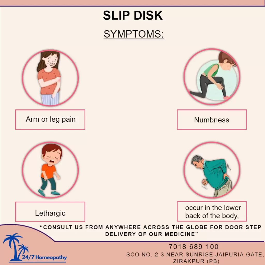 slip disc homeopathy treatment in zirakpur 
