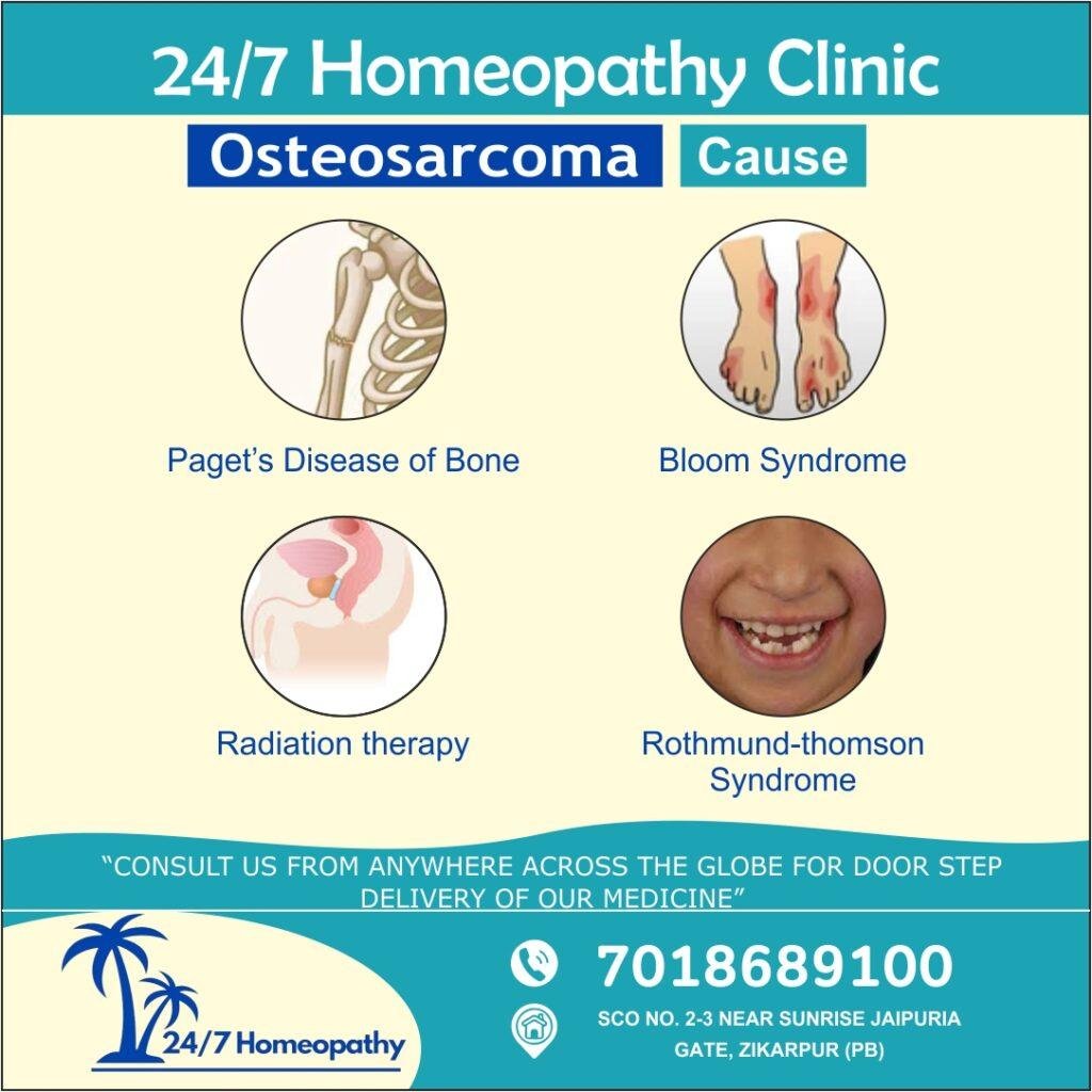 OSTEOSARCOMA  homeopathy treatment 