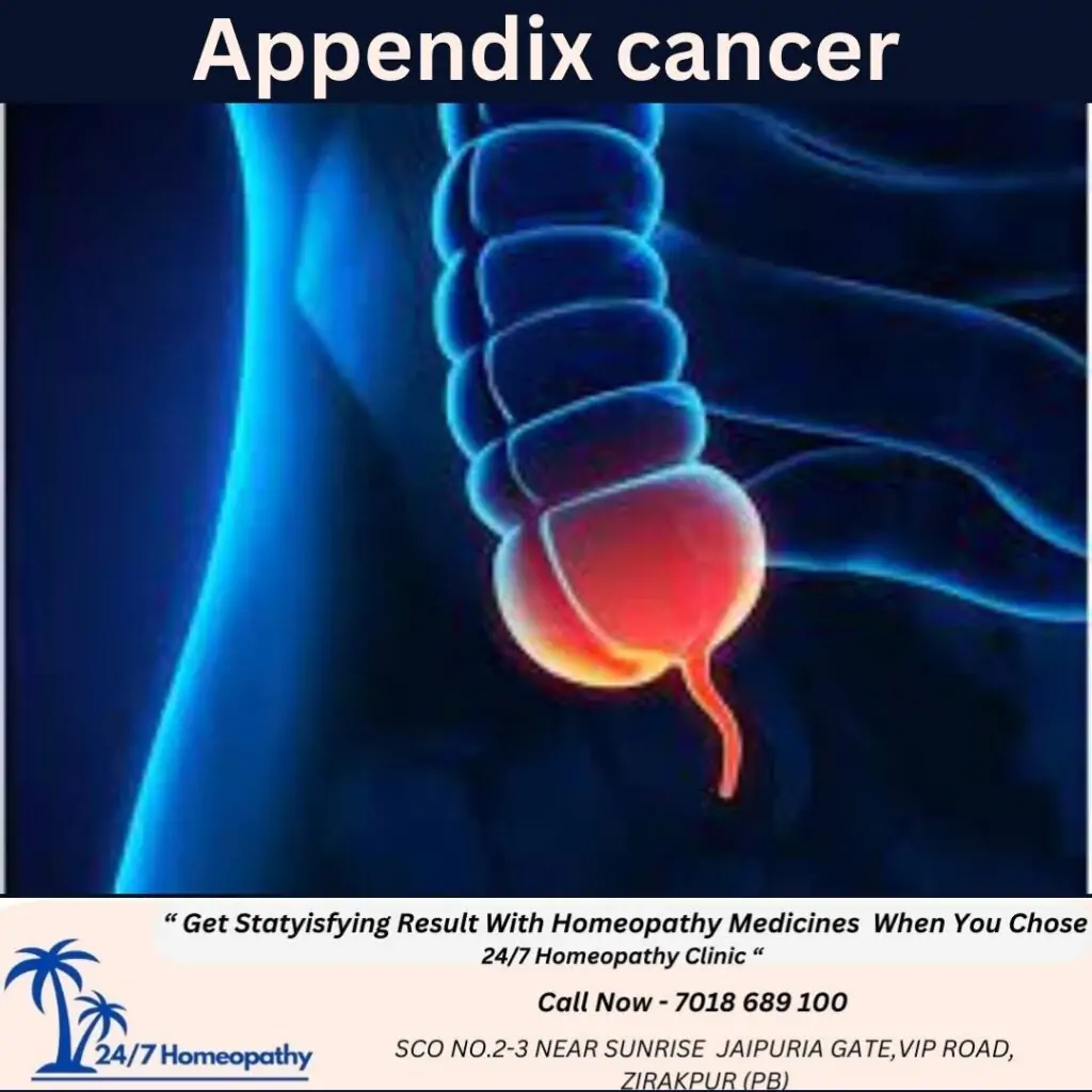 APPENDIX CANCER symptom and homeopathy treatment in zirakpur