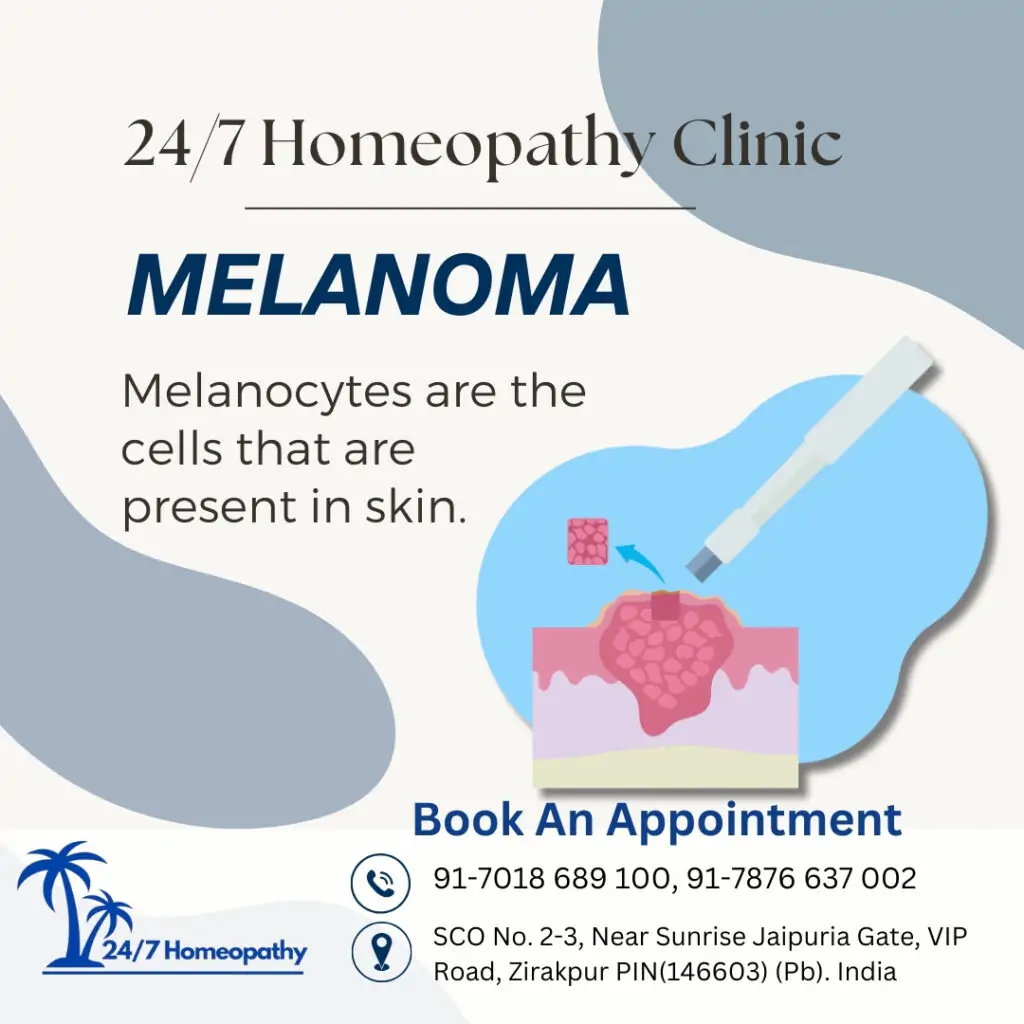 MELANOMA homeopathy treatment in zirakpur