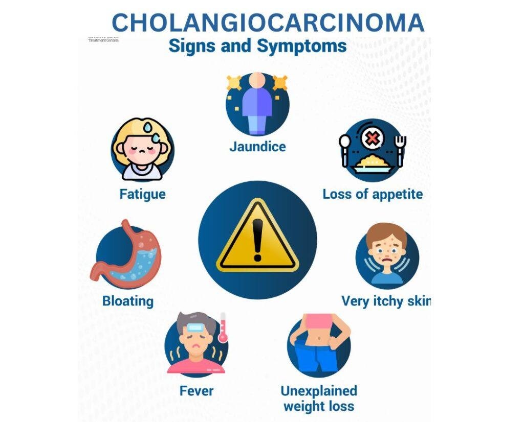 CHOLANGIOCARCINOMA (BILE DUCT CANCER) sign and symptoms