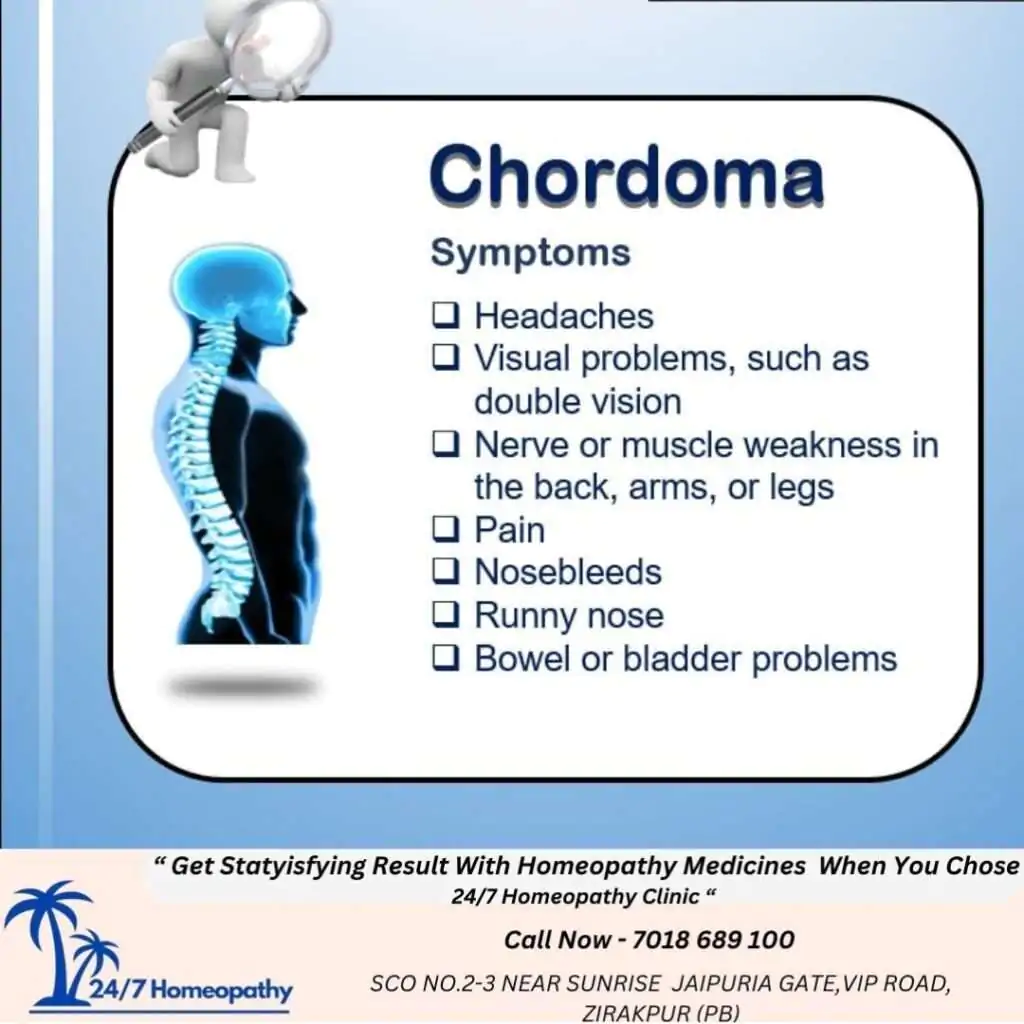CHORDOMAS HOMOEOPATHY TREATMENT zirakpur