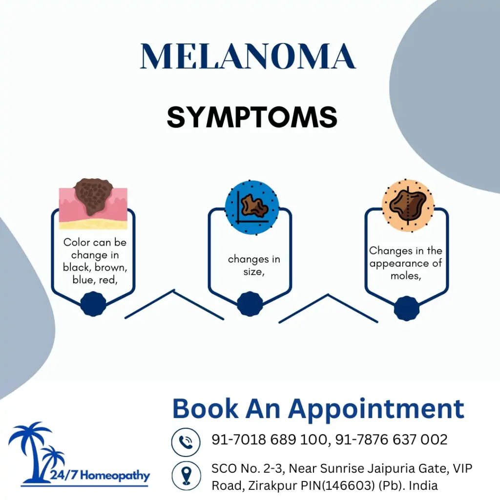 MELANOMA homeopathy treatment in zirakpur