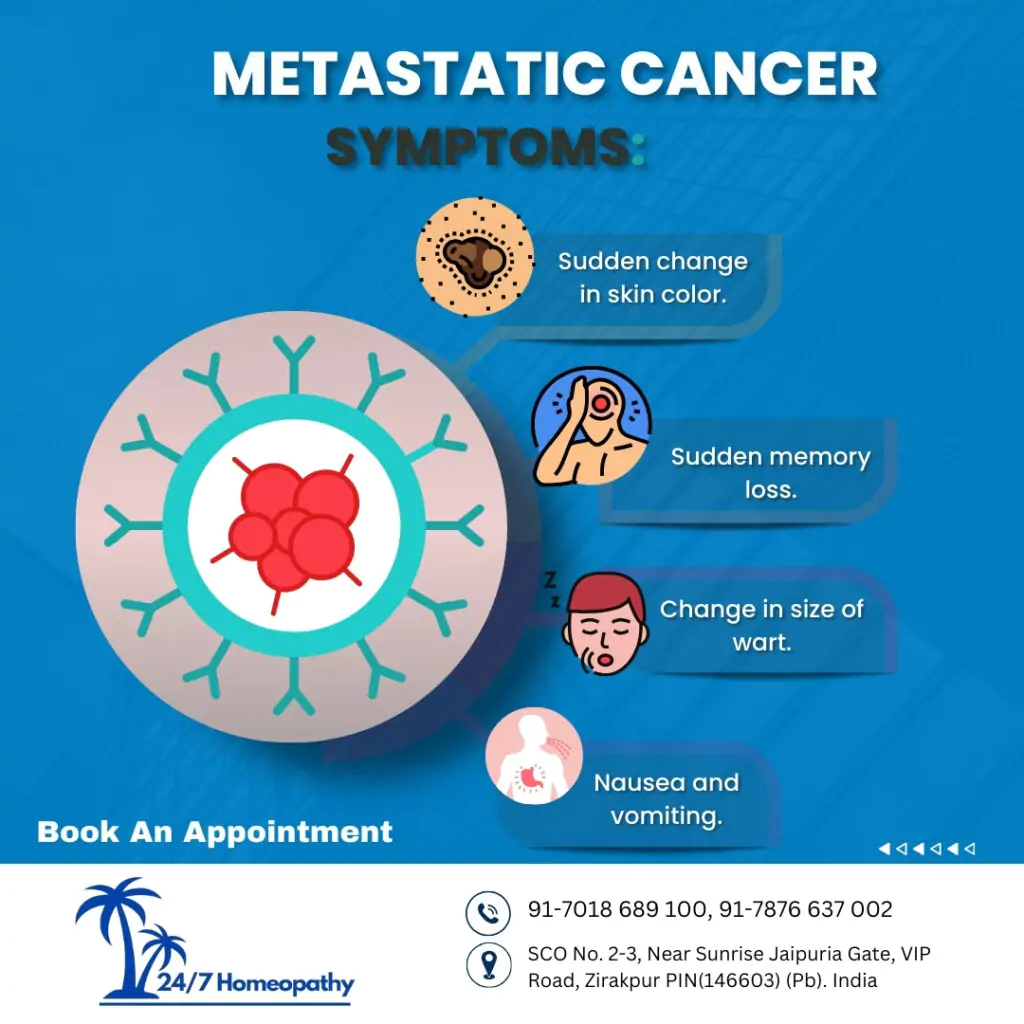 Metastatic cancer homeopathy treatment in zirakpur