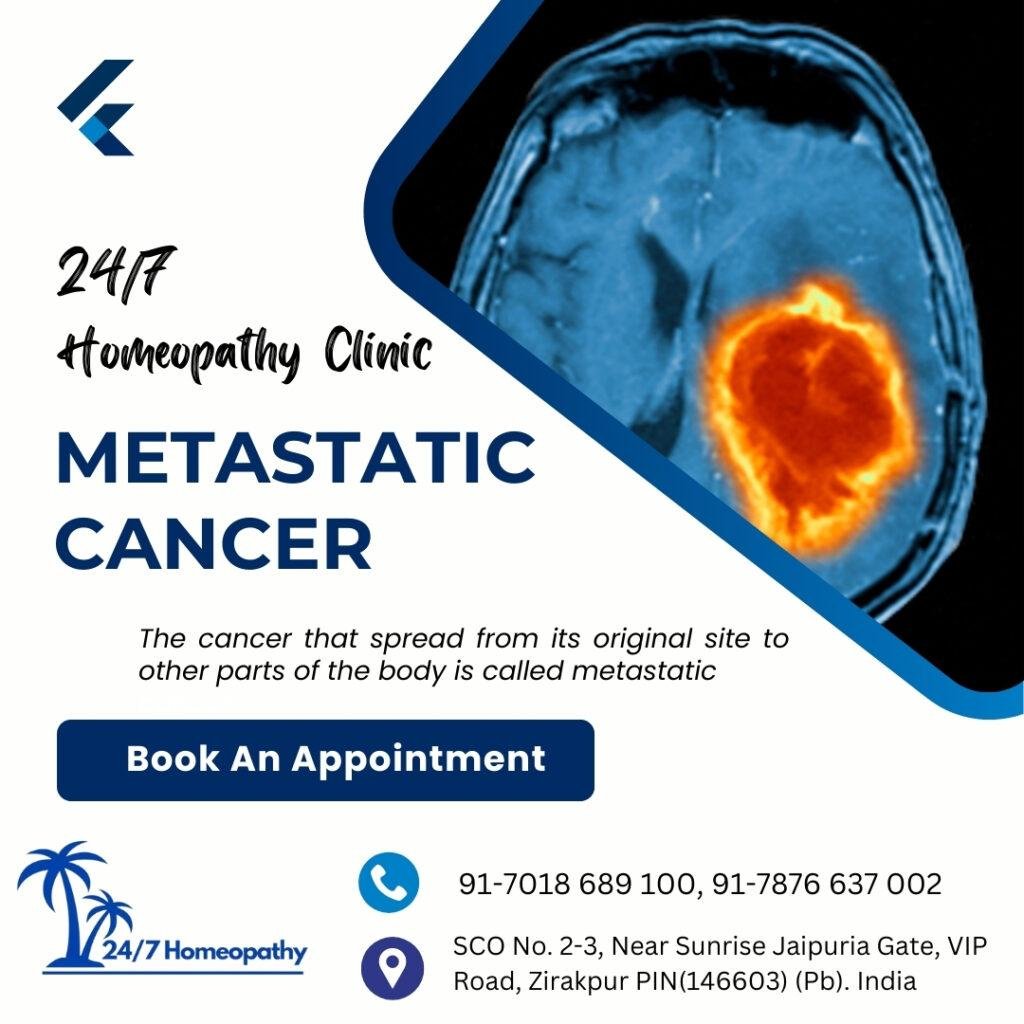 Metastatic cancer homeopathy treatment in zirakpur