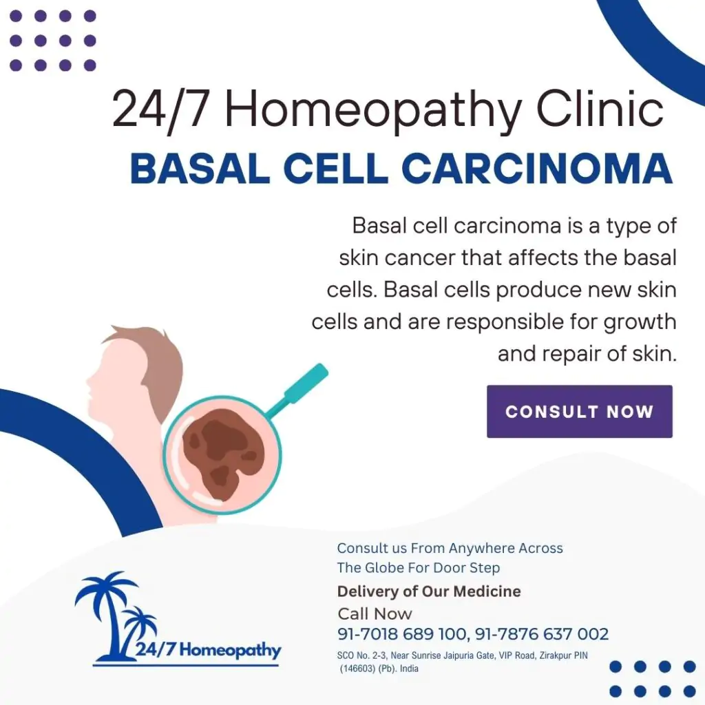 BASAL CELL CARCINOMA HOMOEOPATHIC TREATMENT