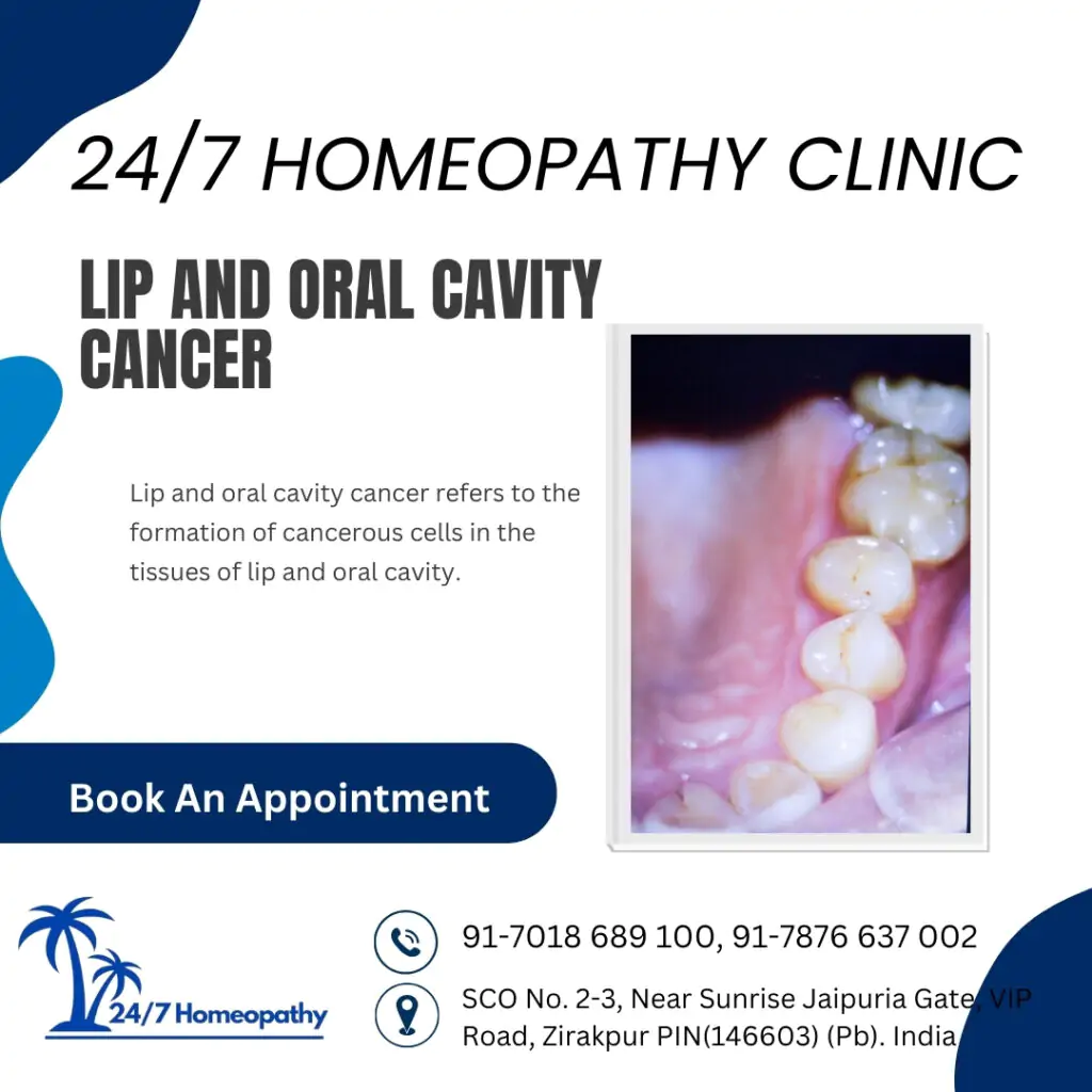 LIP AND ORAL CAVITY CANCER homeopathy treatment in zirakpur