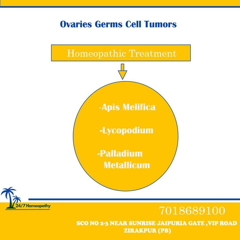 OVARIAN GERMS CELL TUMORS homeopathy treatment by Dr RUCHI IN ZIRAKAPUR