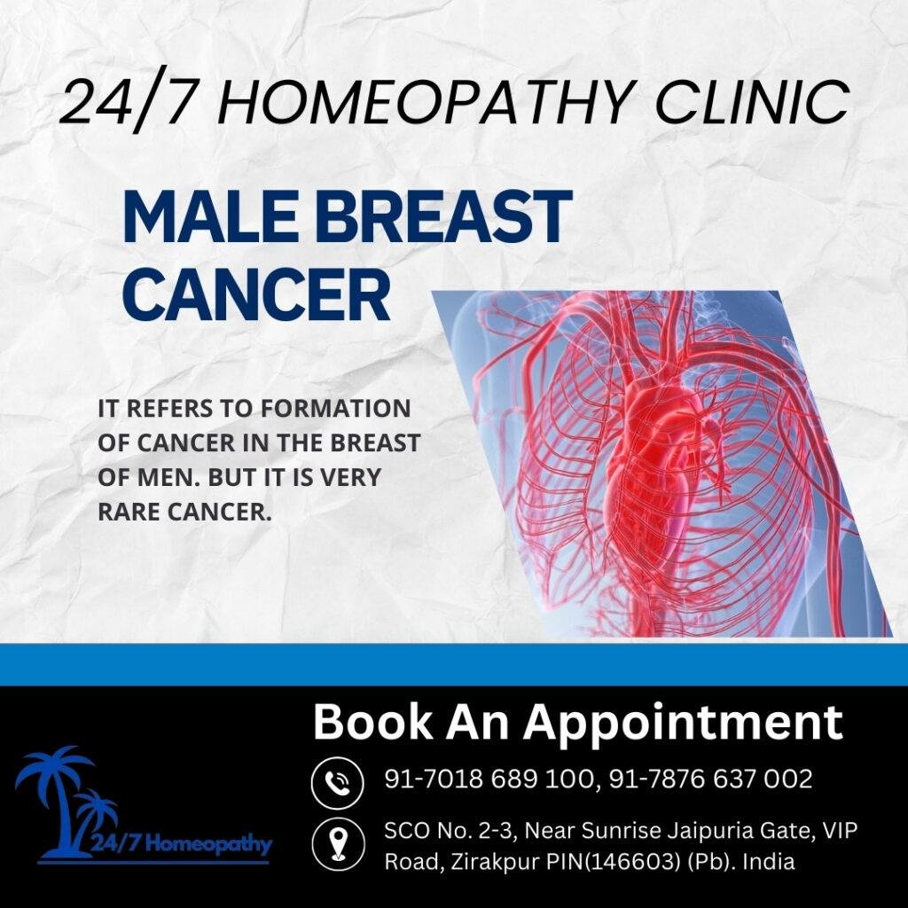 MALE BREAST CANCER homeopathy treatment in zirakpur