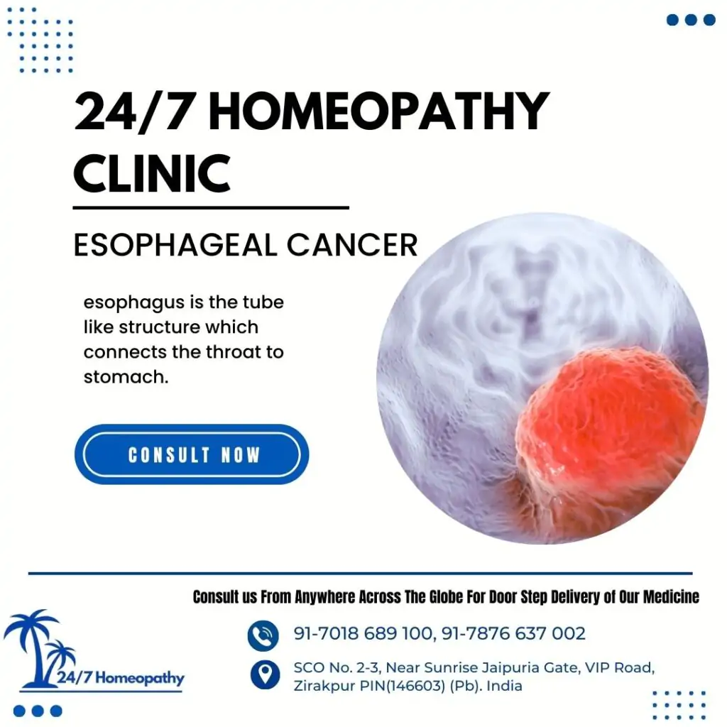 ESOPHAGEAL CANCER HOMOEOPATHIC MEDICINE in zirakpur
