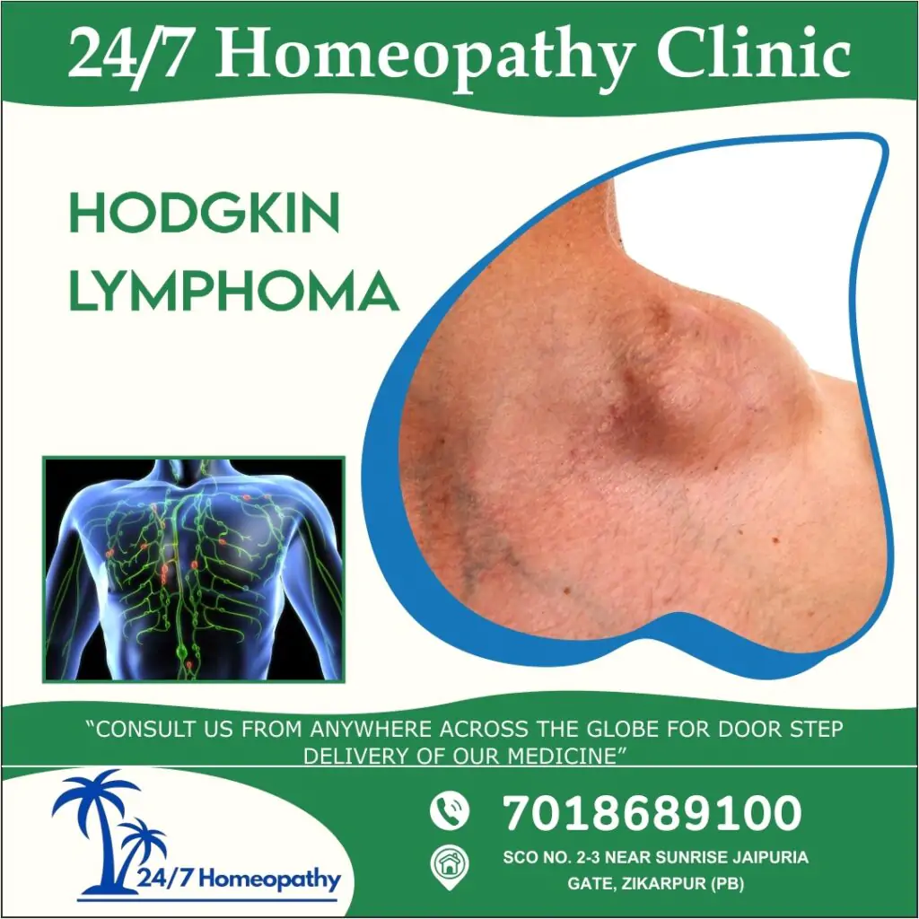 HODGKIN LYMPHOMA homeopathy treatment zirakpur