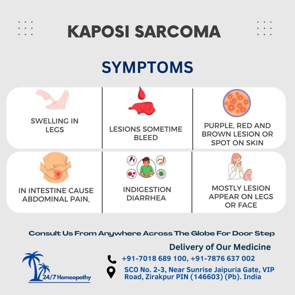 SYMPTOMS of KAPOSI SARCOMA AND TREATMENTby Dr Ruchi - 247Homeopathy clinic zirakpur