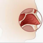 NASAL CAVITY AND PARANASAL CANCER