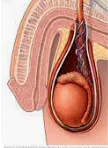 TESTICULAR GERM CELL CANCER