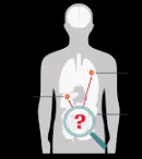 CANCER OF UNKNOWN PRIMARY