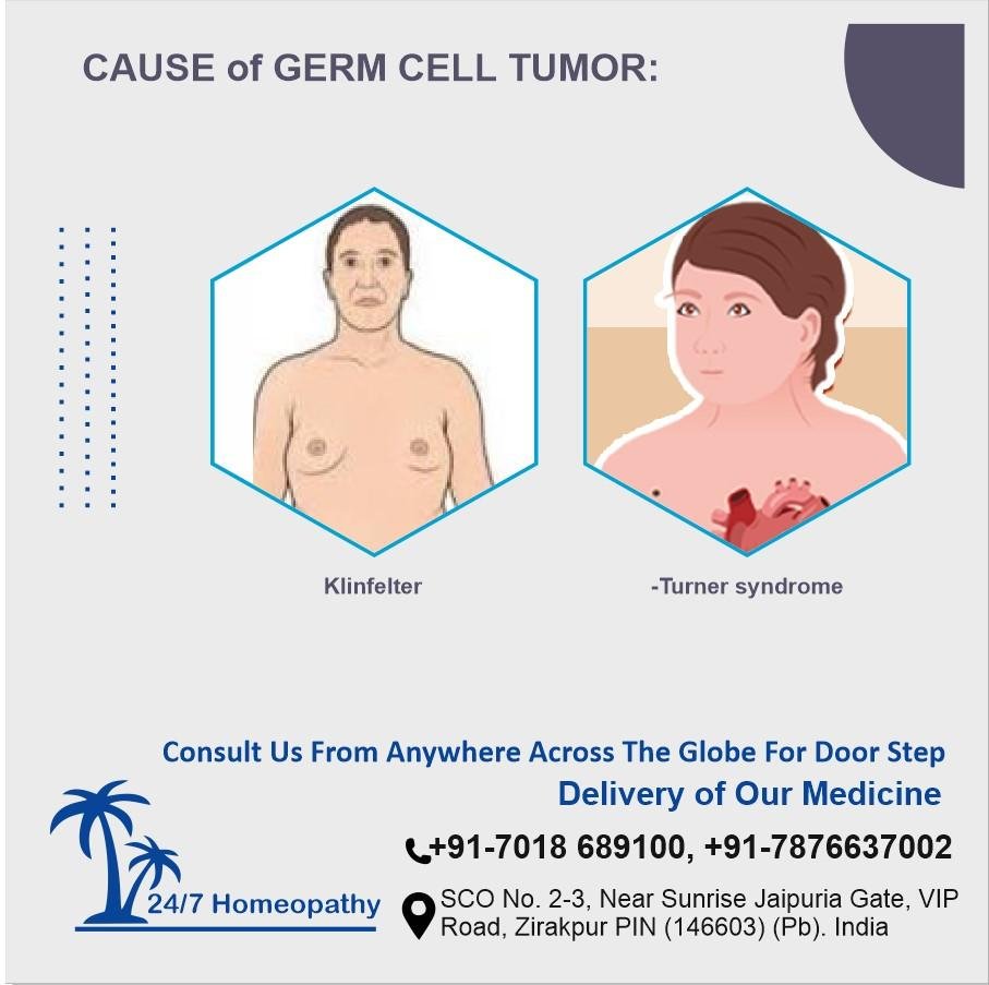 Causes of germ cell tumor