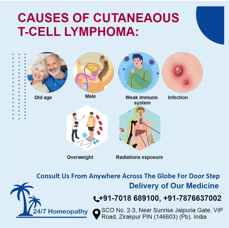 Cutaneaous T- Cell Lymphoma causes and homeopathy treatment