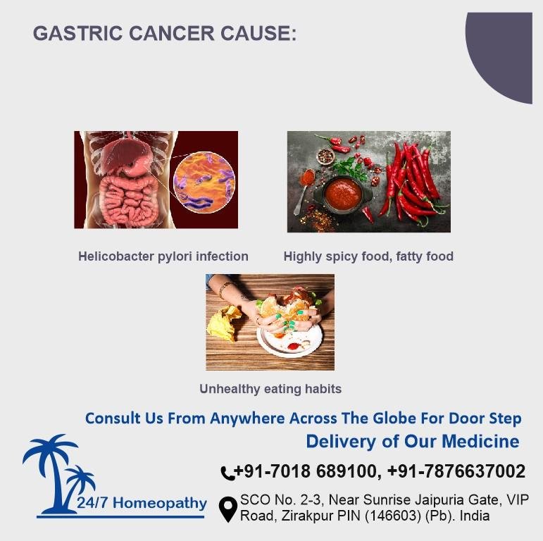 Gastric cancer Causes and Homeopathy treatment