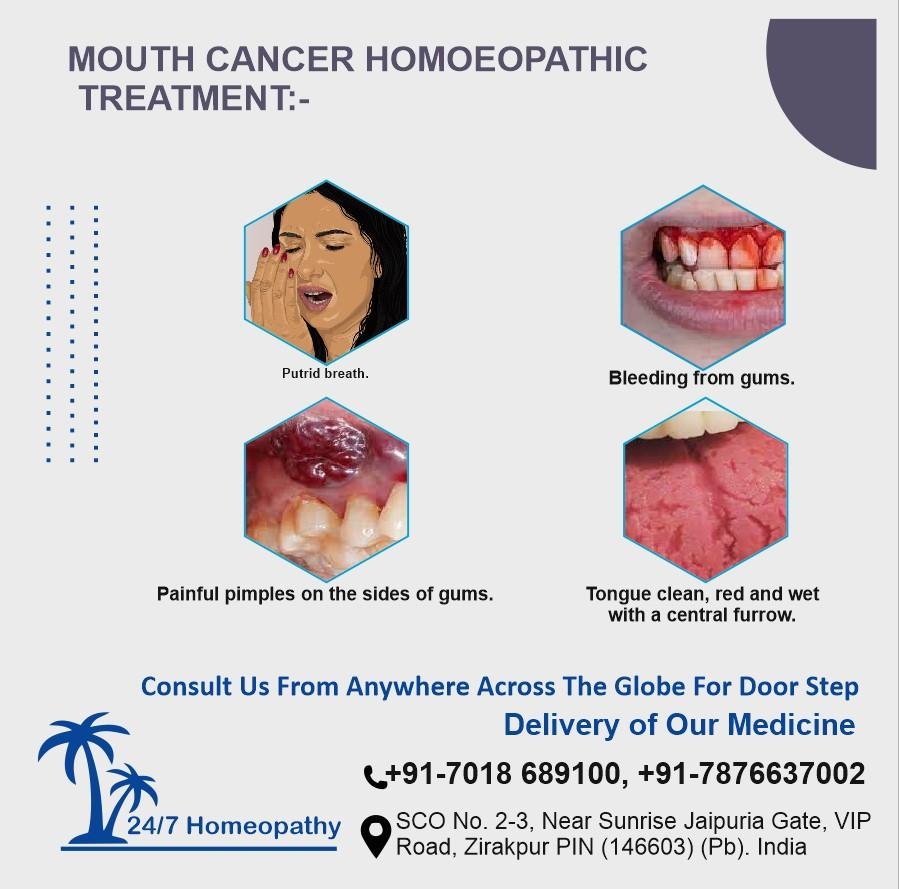 Mouth cancer homeopathy treatment