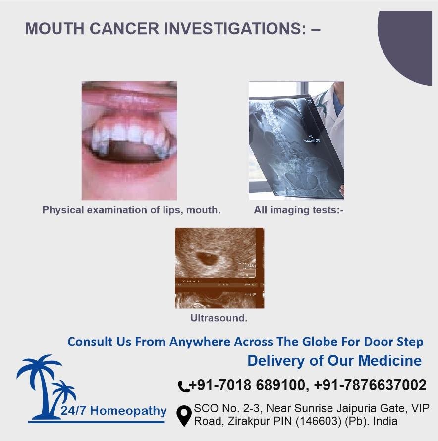 Mouth cancer investigation