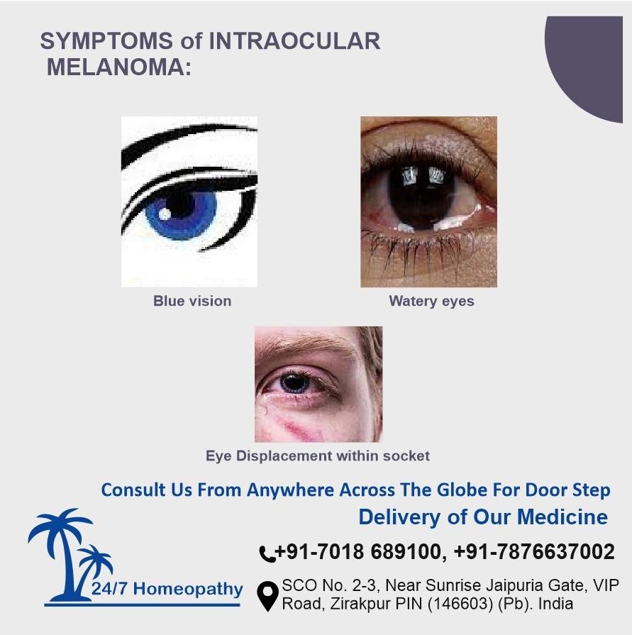 Symptom of intraocular Melanoma