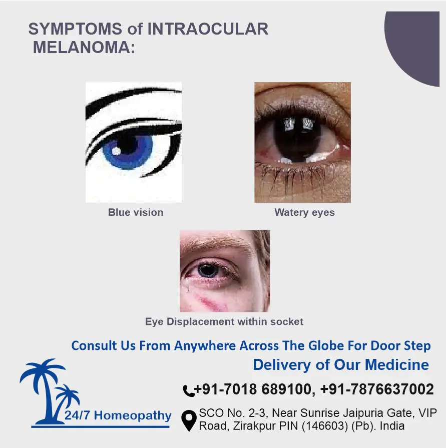 Symptom of intraocular Melanoma