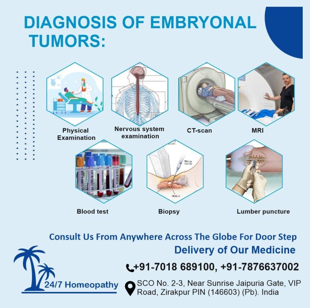 embryonal tumor homeopathy treatment