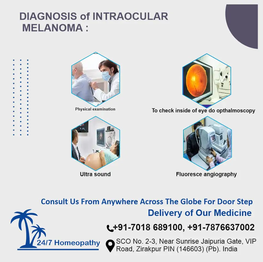 intracular Melanoma treatment